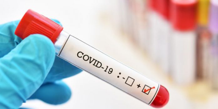 coronavirus.COVID19.4.000