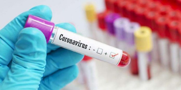 coronavirus.positive.1 768x384 1